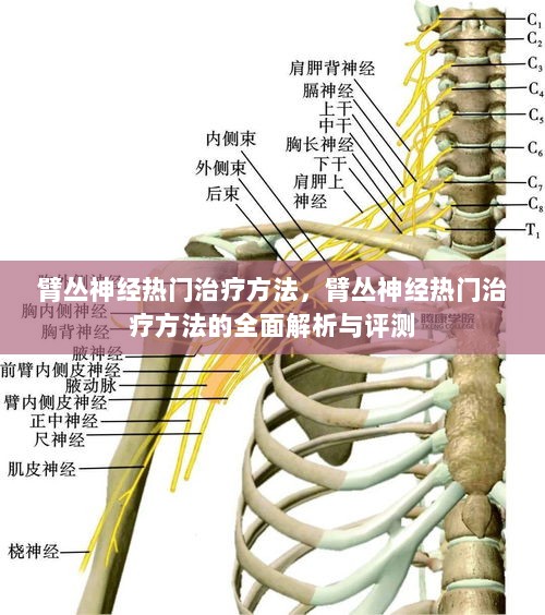 臂丛神经热门治疗方法的全面解析与评测