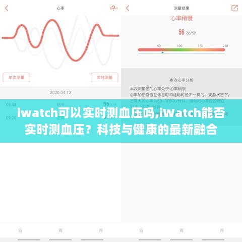 iWatch实时血压监测功能，科技与健康的最新融合探索