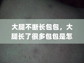 大腿不断长包包，大腿长了很多包包是怎么回事 