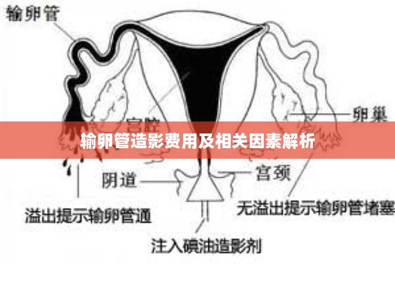 输卵管造影费用及相关因素解析