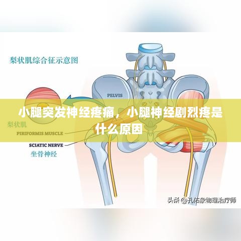 小腿突发神经疼痛，小腿神经剧烈疼是什么原因 