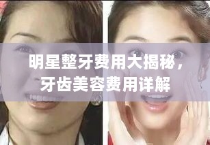 明星整牙费用大揭秘，牙齿美容费用详解