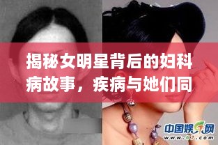 揭秘女明星背后的妇科病故事，疾病与她们同行