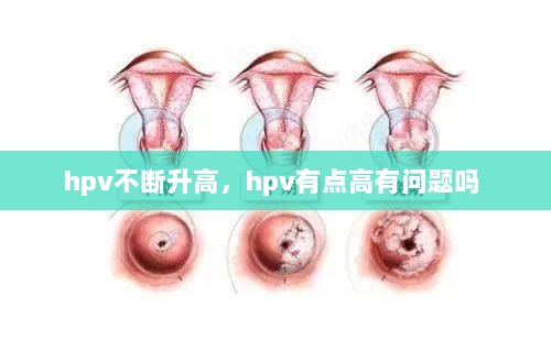 hpv不断升高，hpv有点高有问题吗 